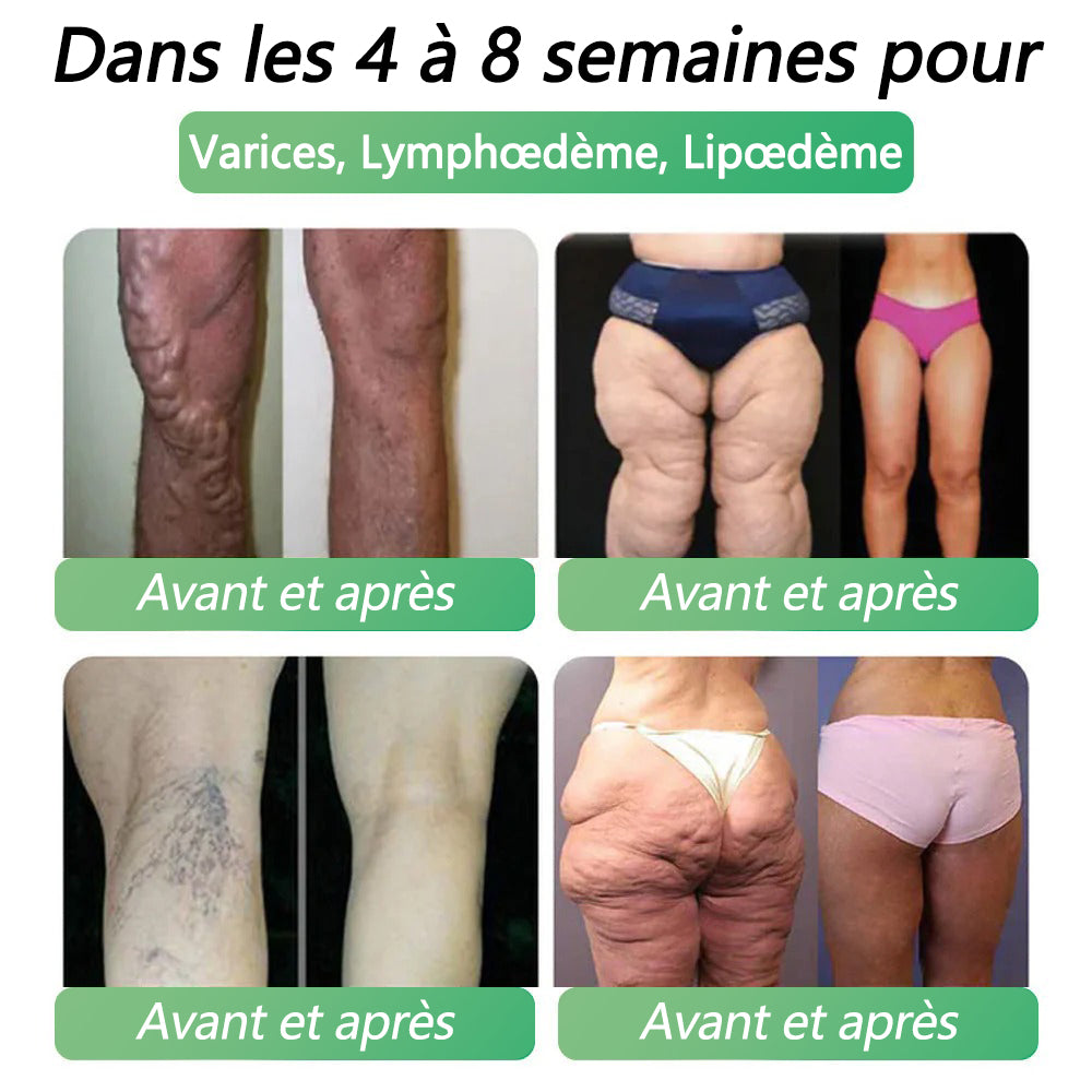 ❤️𝑩𝒐𝒖𝒕𝒊𝒒𝒖𝒆 𝒐𝒇𝒇𝒊𝒄𝒊𝒆𝒍𝒍𝒆 |𝐂𝐯𝐫𝐞𝐨𝐳® GLP-1 Liquide pour la santé 6 en 1 (Une seule dose par jour - resultats visibles des 7 jours)