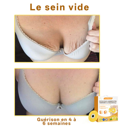 🌺【Boutique officielle】𝐇𝐔𝐃𝐑𝐎𝐒®🩰 Patch à la gelée royale pour l’augmentation mammaire sans danger lors de l’allaitement